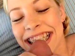 Cutie Takes A Load On Her Braces Free Porn Ec Xhamster